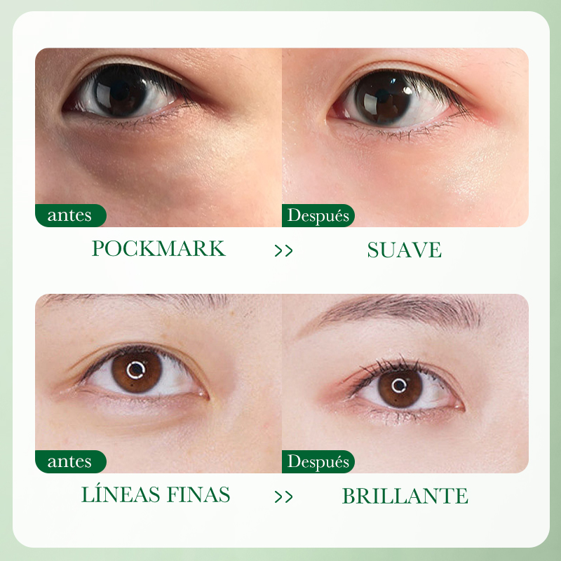 Antes y Después del uso